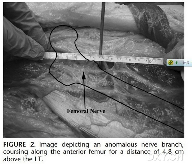 星空官网登录-暖气片什么材质的好？(图1)